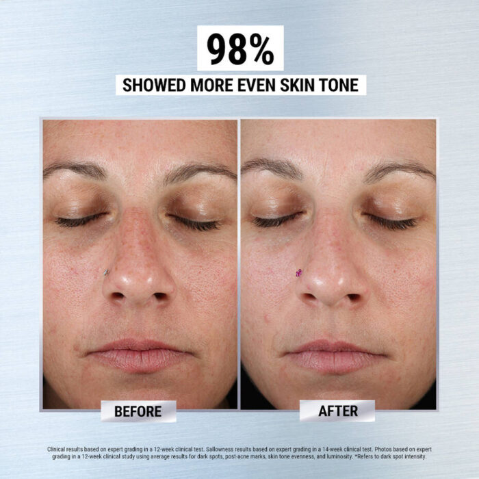 Kiehl’s Clearly Corrective Dark Spot Corrector - Image 7